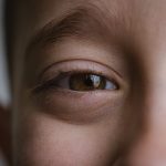 Augen unter Druck
