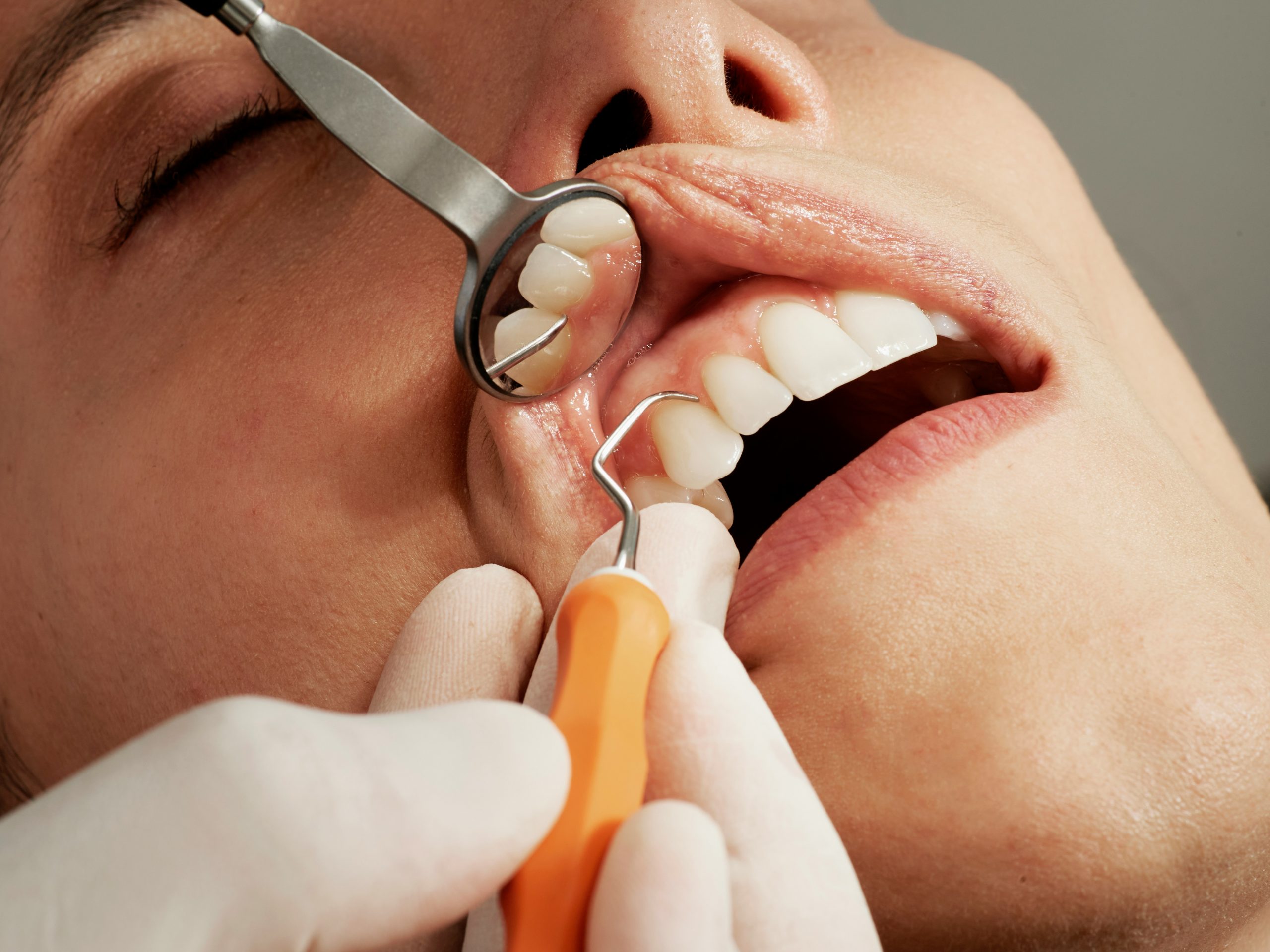 Kontrollen beim Zahnarzt